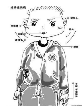 抽动症用大脑生物反馈治疗仪可以吗？最好的治疗方法吗？