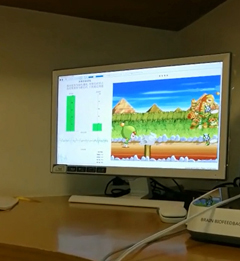 大脑生物反馈治疗仪注意力训练